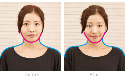 before after女性