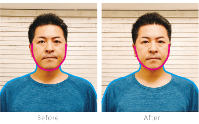 before after男性